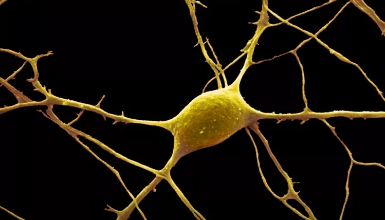 neuron from cerebellum